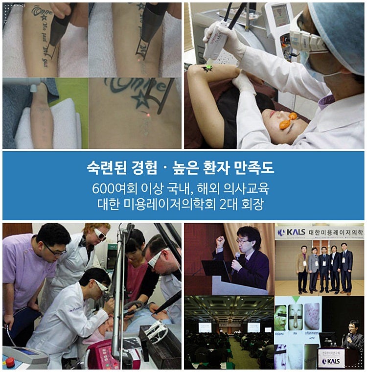 타투 지우는 장소 치료 보장제로 결과 만족도 up 12