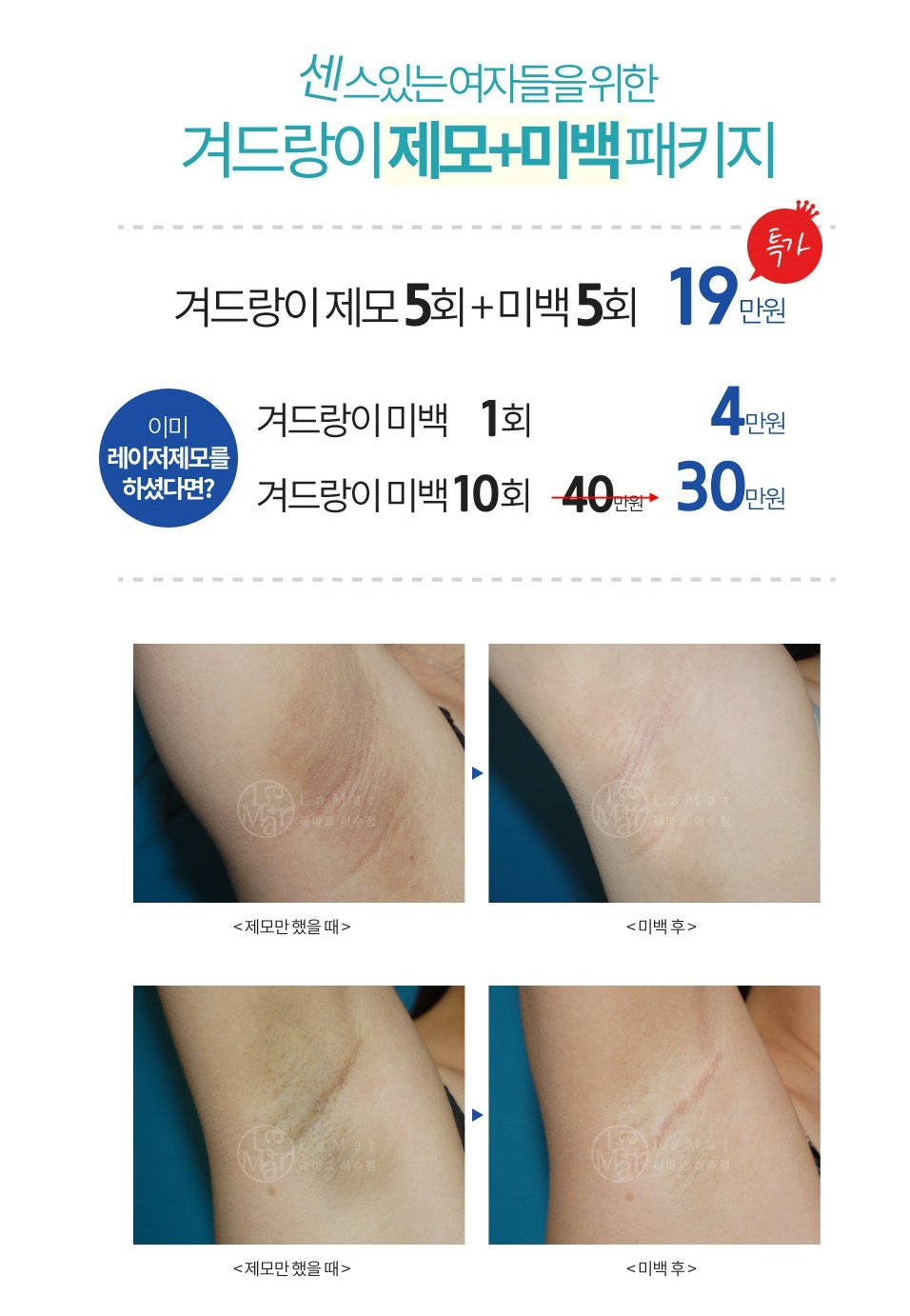 사당동제모, 라마르이수에서 말끔하게~ : 네이버 포스트
