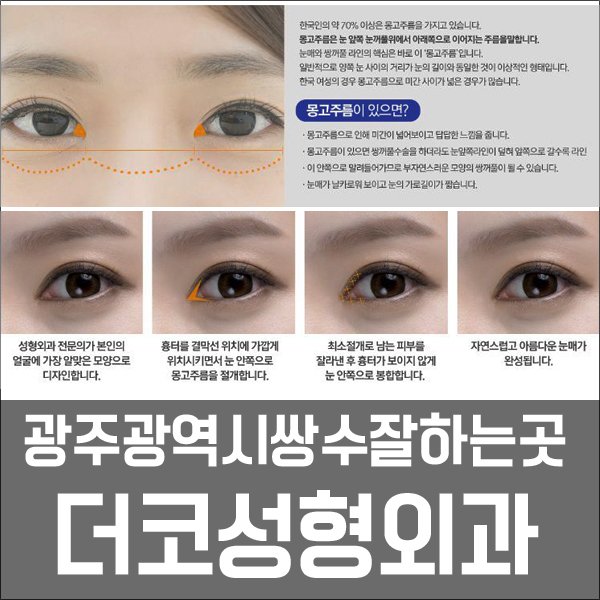 광주 쌍꺼풀 수술의 쌍수 가격이 궁금하신 분들은