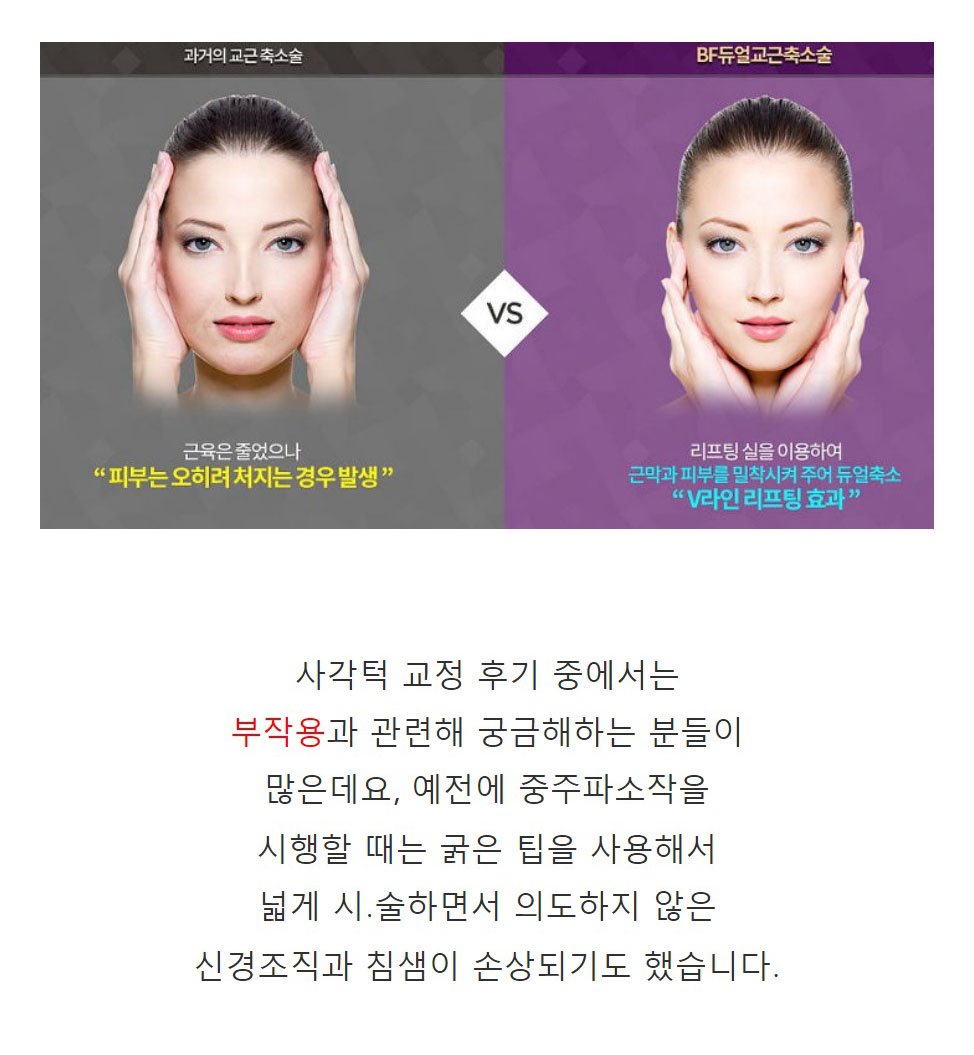교근축소술부작용 적은 방식? : 네이버 포스트