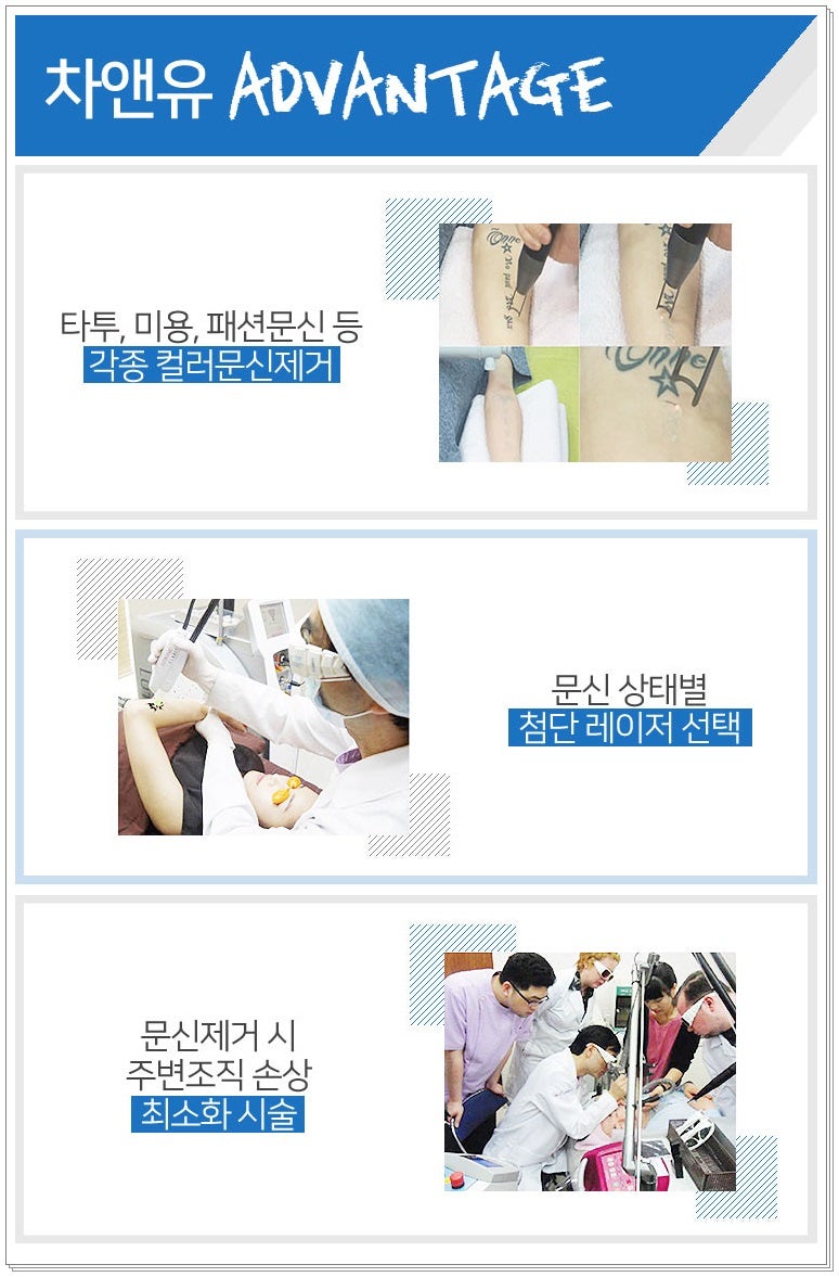 타투 지우는 장소 치료 보장제로 결과 만족도 up 11