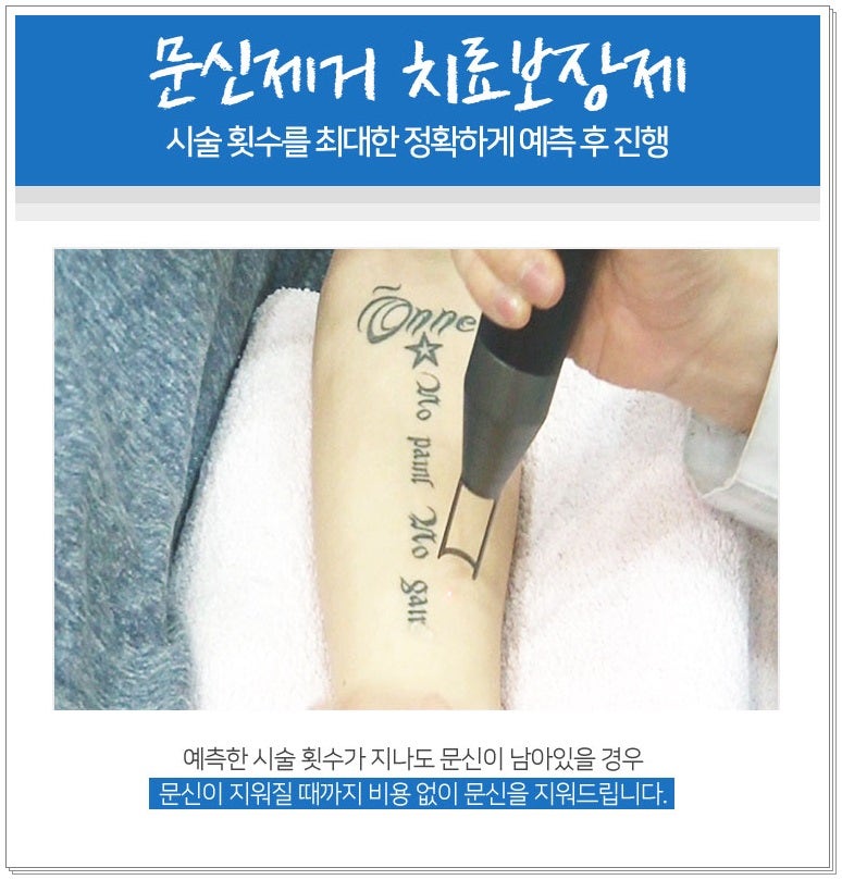 타투 지우는 장소 치료 보장제로 결과 만족도 up 2