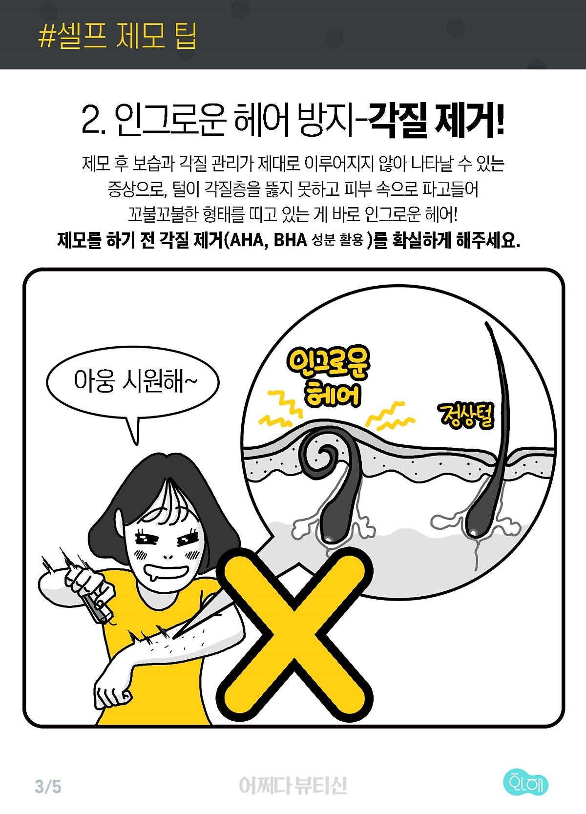 탈모크림 추천 봉봉 셀프왁싱크림 발모에서 잉그로운 헤어 제거, 예쁘게! 4