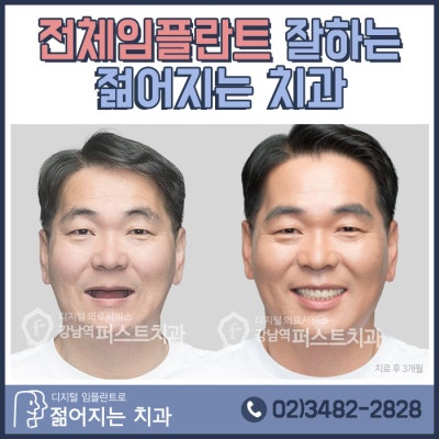 계산동치과의 전체 임플란트 비용을 줄여 받은 사례 4