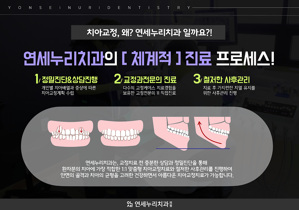 평택치아교정가격 사후관리까지 철저하게 2