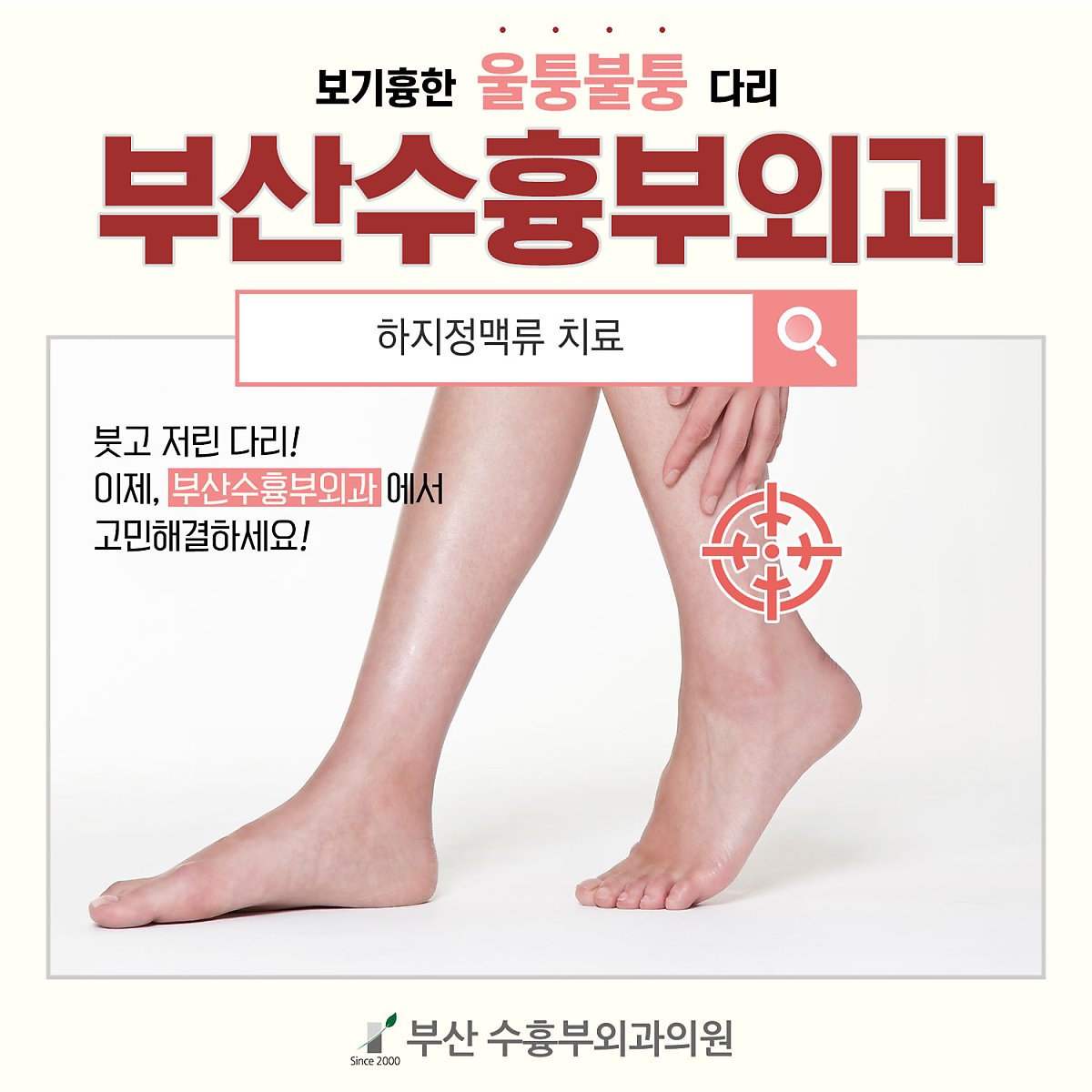 공주보령하지정맥류 with 흉부외과 전문의