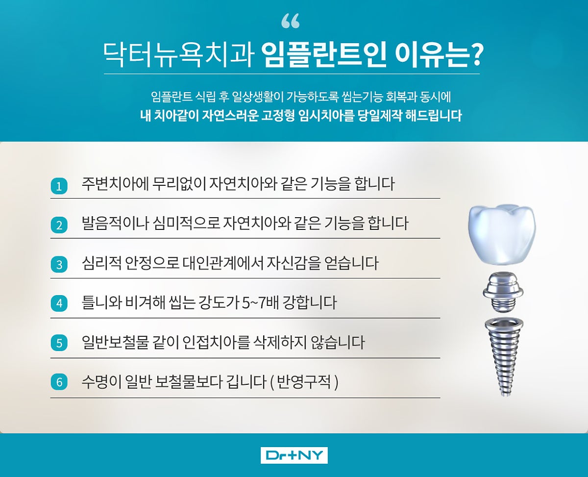 운정 임플란트의 가격을 비교하여 진행하다