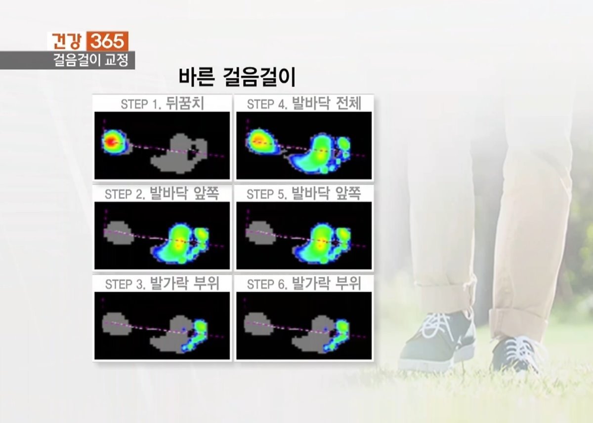 어린이평발 증상으로 걸음걸이가 이상하다면? : 네이버 포스트