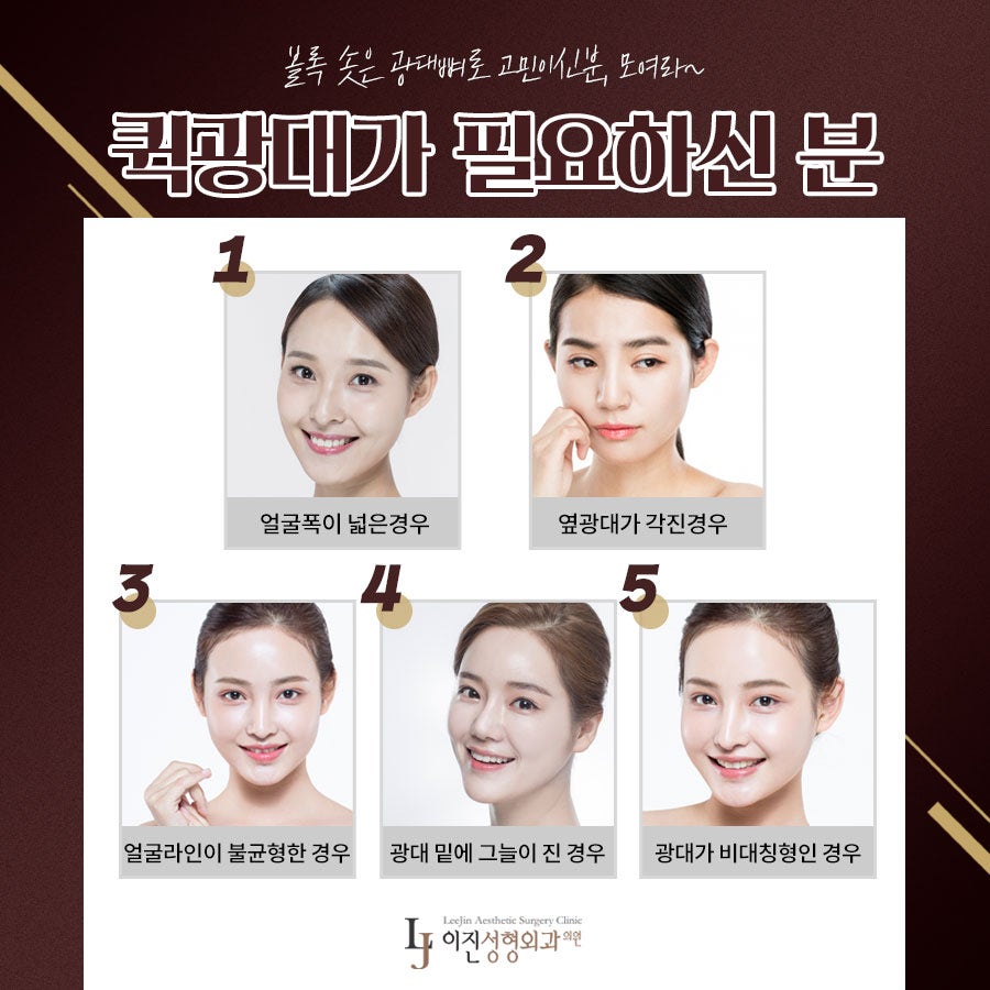 부산광대수술 잘하는곳 이곳인가요 3