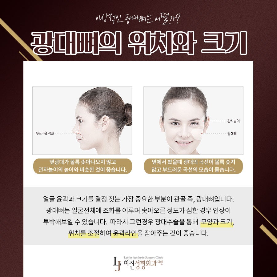 부산광대수술 잘하는곳 이곳인가요 4