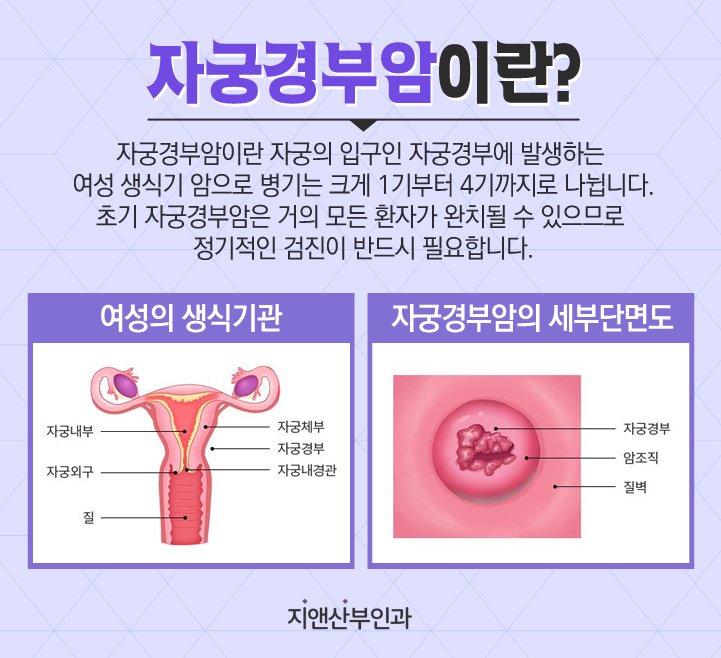 자궁경부암검진 : 절차 및 방법설명