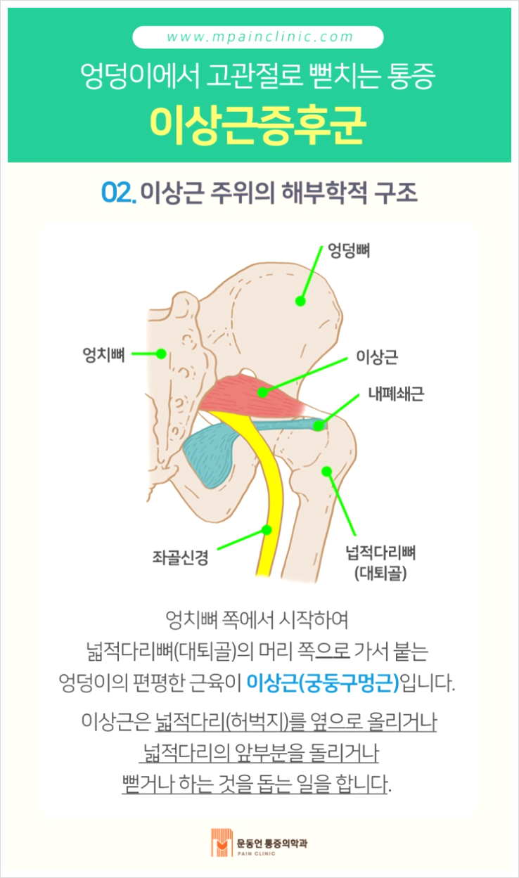 반포 엉덩이통증 좌골신경통 증상 및 완화법 9