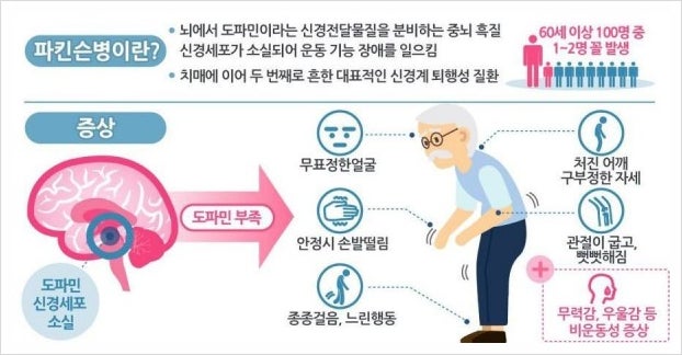 파킨슨병 초기증상 운동 및 비운동성의