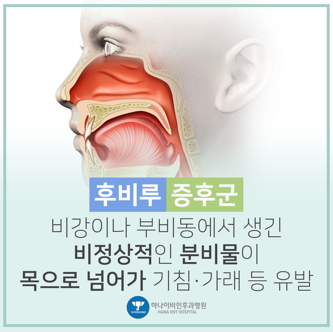 후비루증후군 증상, 가래, 콧물의 원인