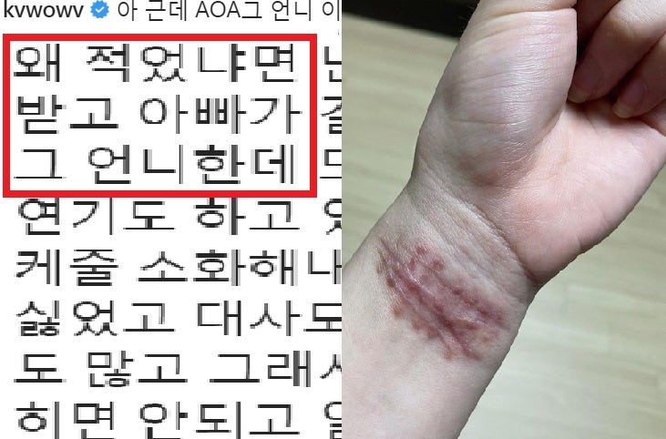 images 권민아 손목 ê¶ë¯¼ì aoa ì§ë¯¼ ìê² ì목 ì¬ì§ ë³´ë´ë©° í ë§ ì ê²½ ì¸ì¤í ë¤ì´ë² í¬ì¤í¸