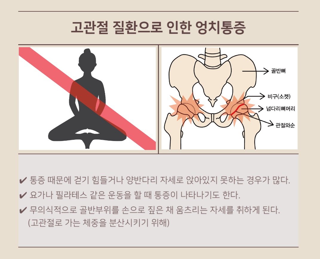 엉치통증의 원인, '고관절 질환' (Feat.고관절내시경) : 네이버 포스트