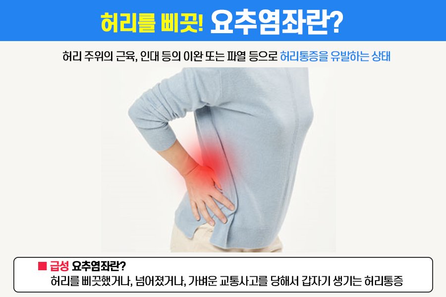 허리 삐끗했을때 발생하는 급성요추염좌