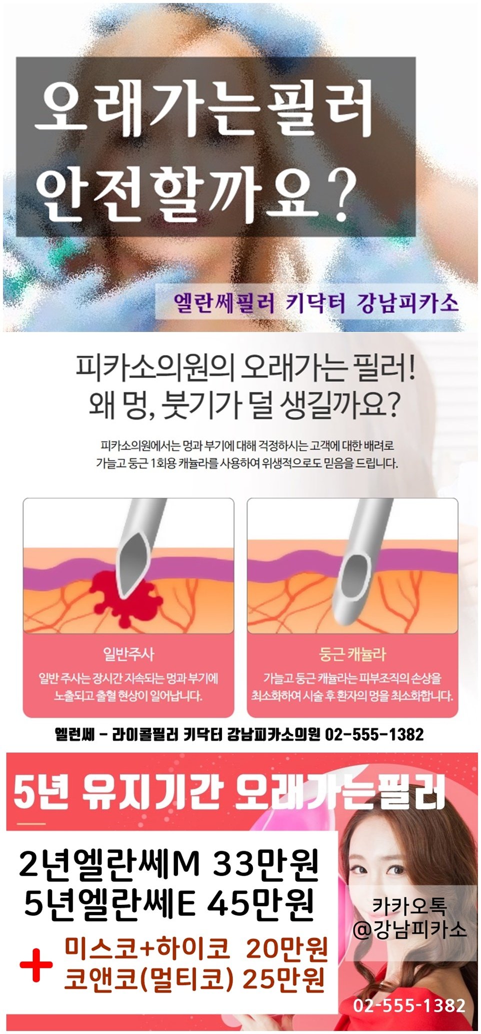 강남역 피부과 액자필러 리뷰 / 엘란세 유지기간, 부작용