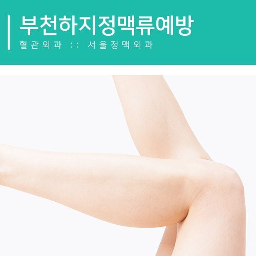 부천지역 하지정맥류 예방을 지속적으로 추진