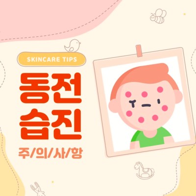 아기 동전습진 만성이 되기 전에 관리해 주세요!