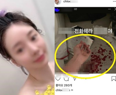 황하나 인스타그램, 손목 자해 사진 올린 끔찍한 상황 (+현장 사진) : 네이버 포스트