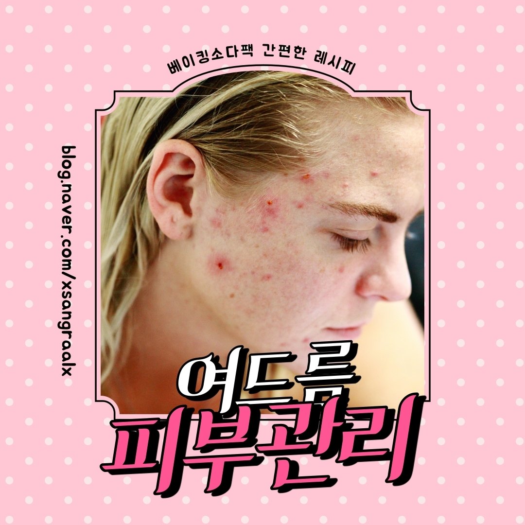 베이킹소다팩 간편하고 확실한 레시피 : 네이버 포스트
