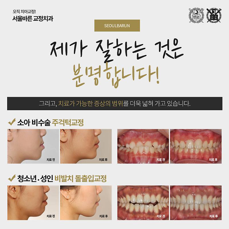인계동 교정치과 교합을 치료하기 위해서는