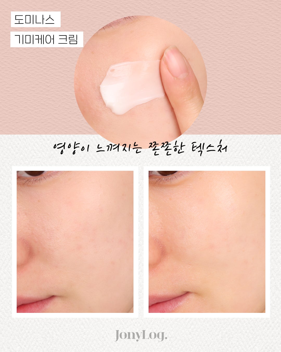 잡티지우개 벨라기미크림으로 집에서