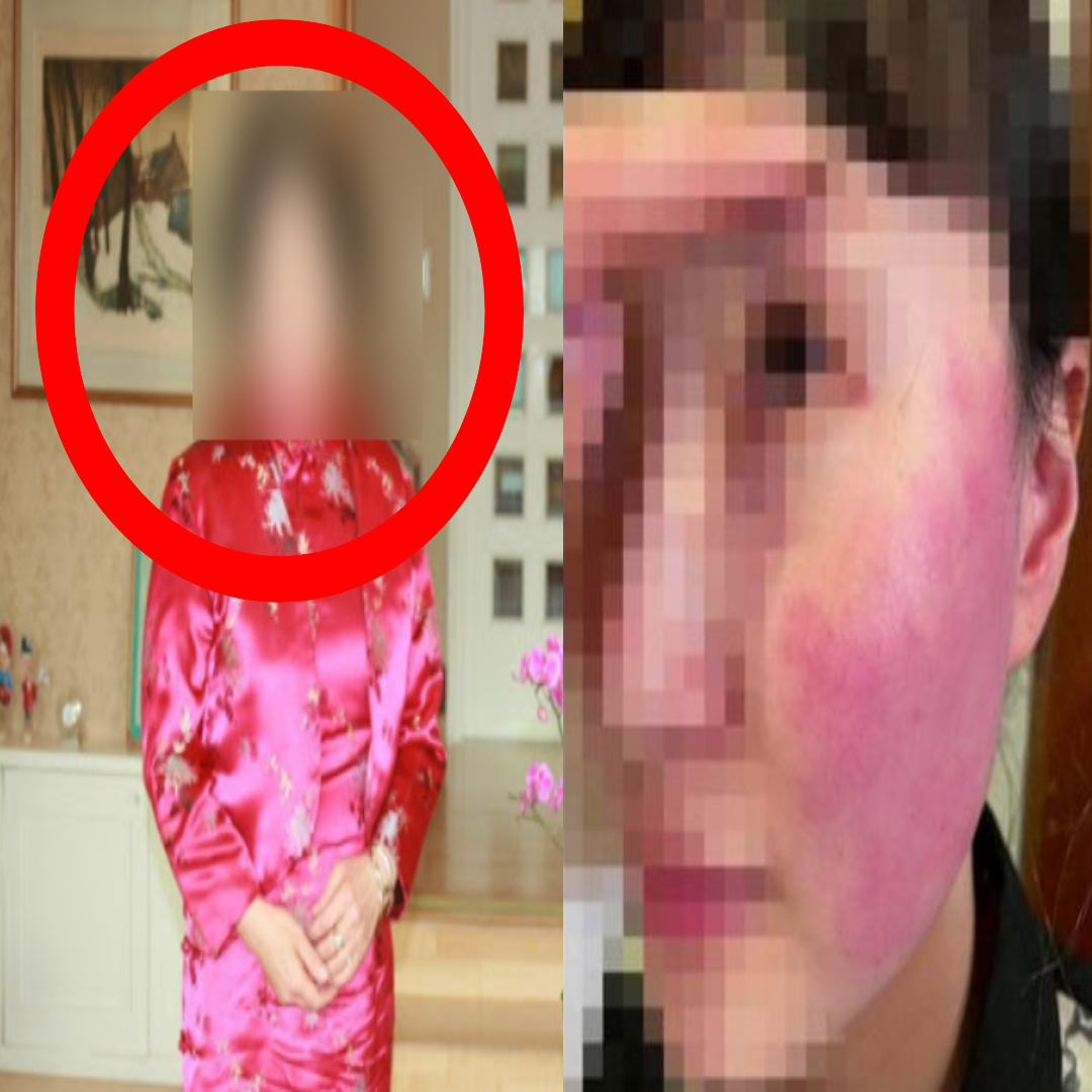 photo 벨기에 대사 부인 국적 ë²¨ê¸°ì— ëŒ€ì‚¬ ë¶€ì¸ í­í–‰ì‚¬ê±´ ë‚œë¦¬ë‚œ í˜„ì§€ ë°˜ì' ì‹ ìƒ cctv ë„¤ì´ë²„ í¬ìŠ¤íŠ¸