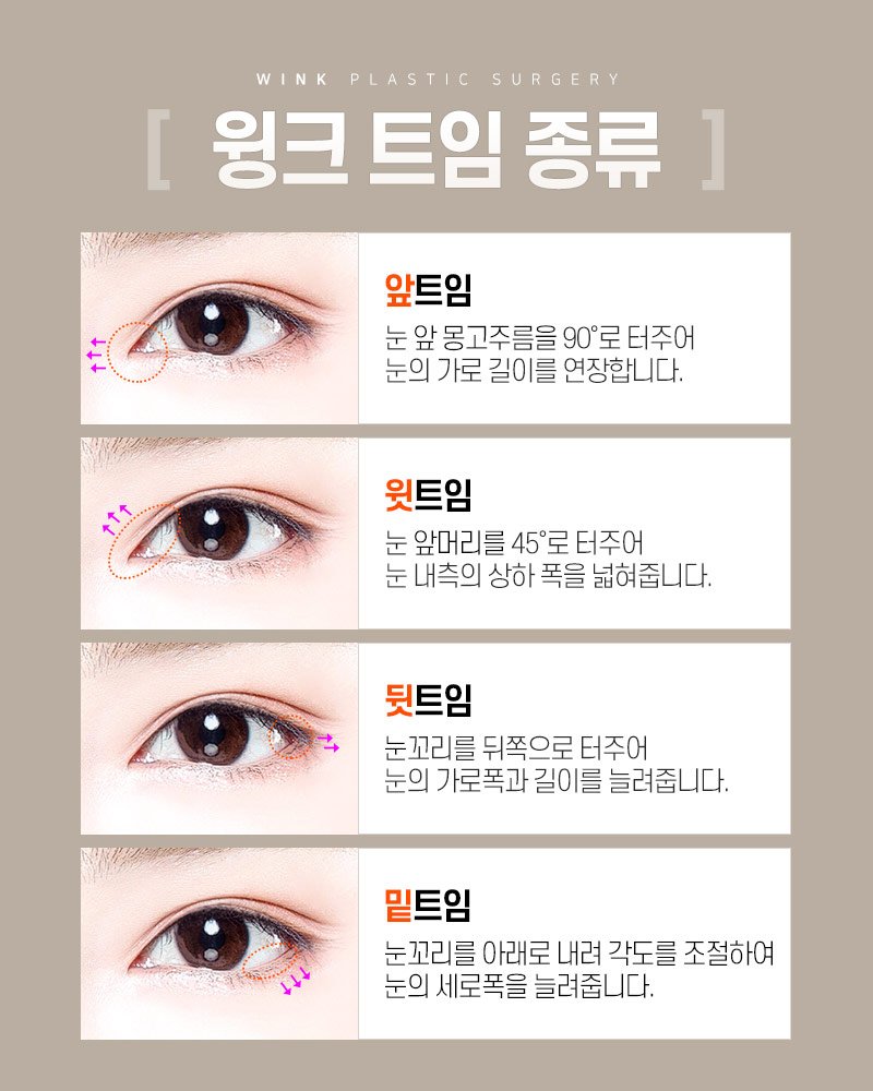 눈성형 잘하는 병원에서 앞트임, 뒷트임 쌍꺼풀 가격은 어떻게 선택해야 할까요?