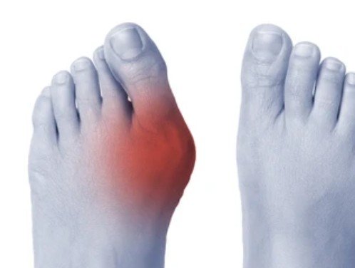 부은 엄지 발가락의 원인과 증상은 무엇입니까?