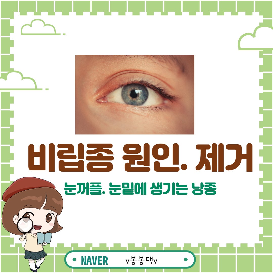 얼굴 눈주변 눈가 눈 비립종 제거 방법, 원인 5