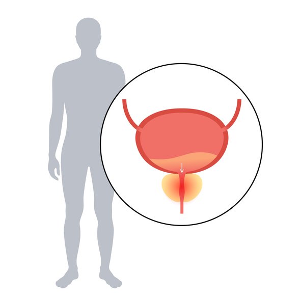 방광 건강에 좋은 식품 8가지