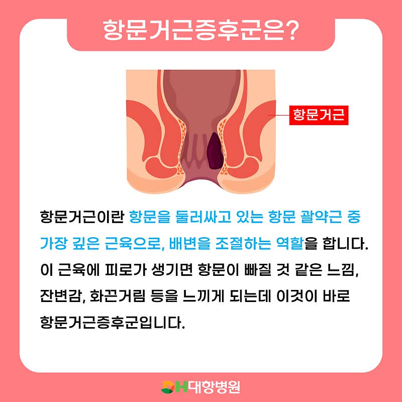 계산역항문거근증후군 한의원 꼬리뼈 부근 통증을 개선하기 위해서는